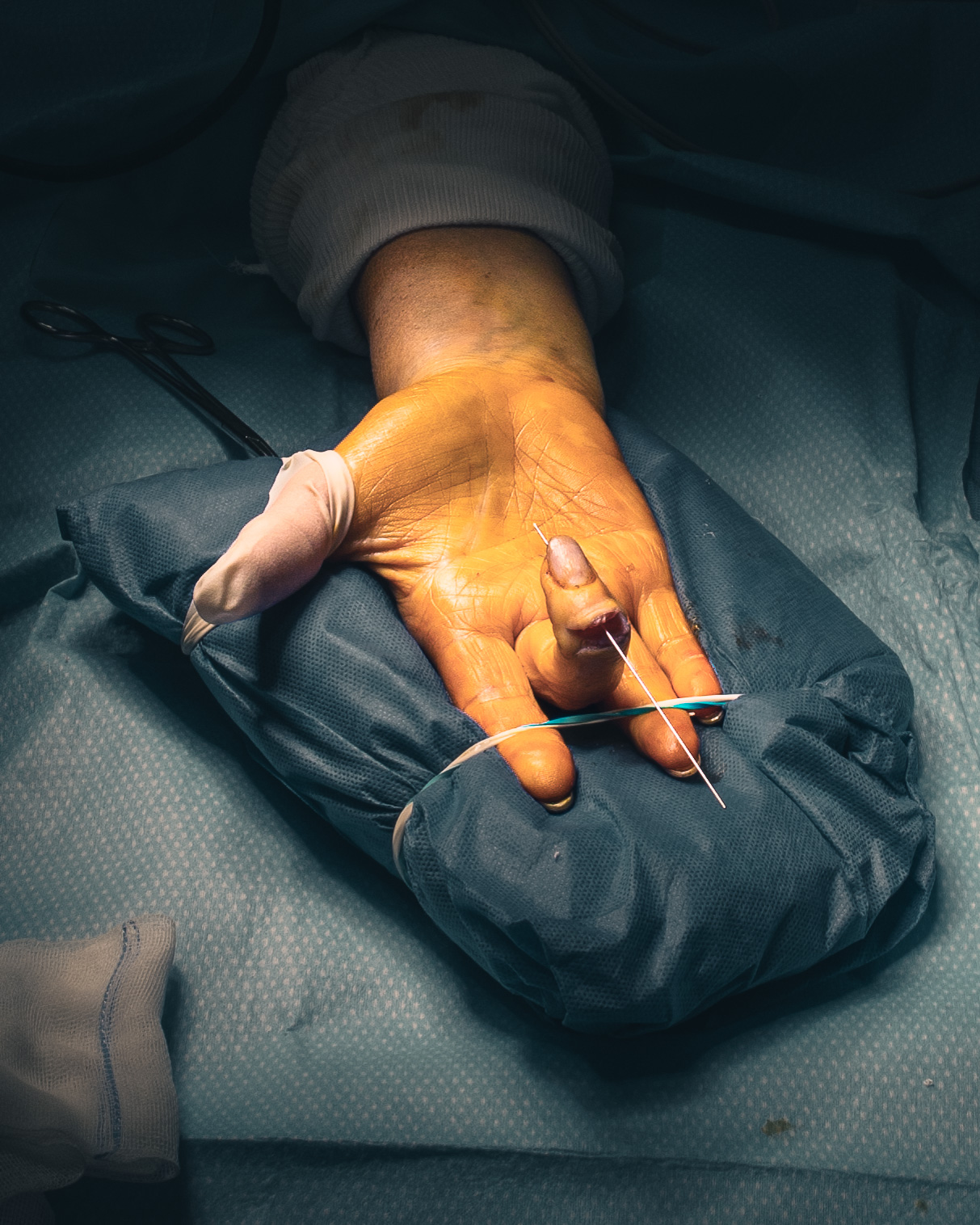 3 months in a surgery room.